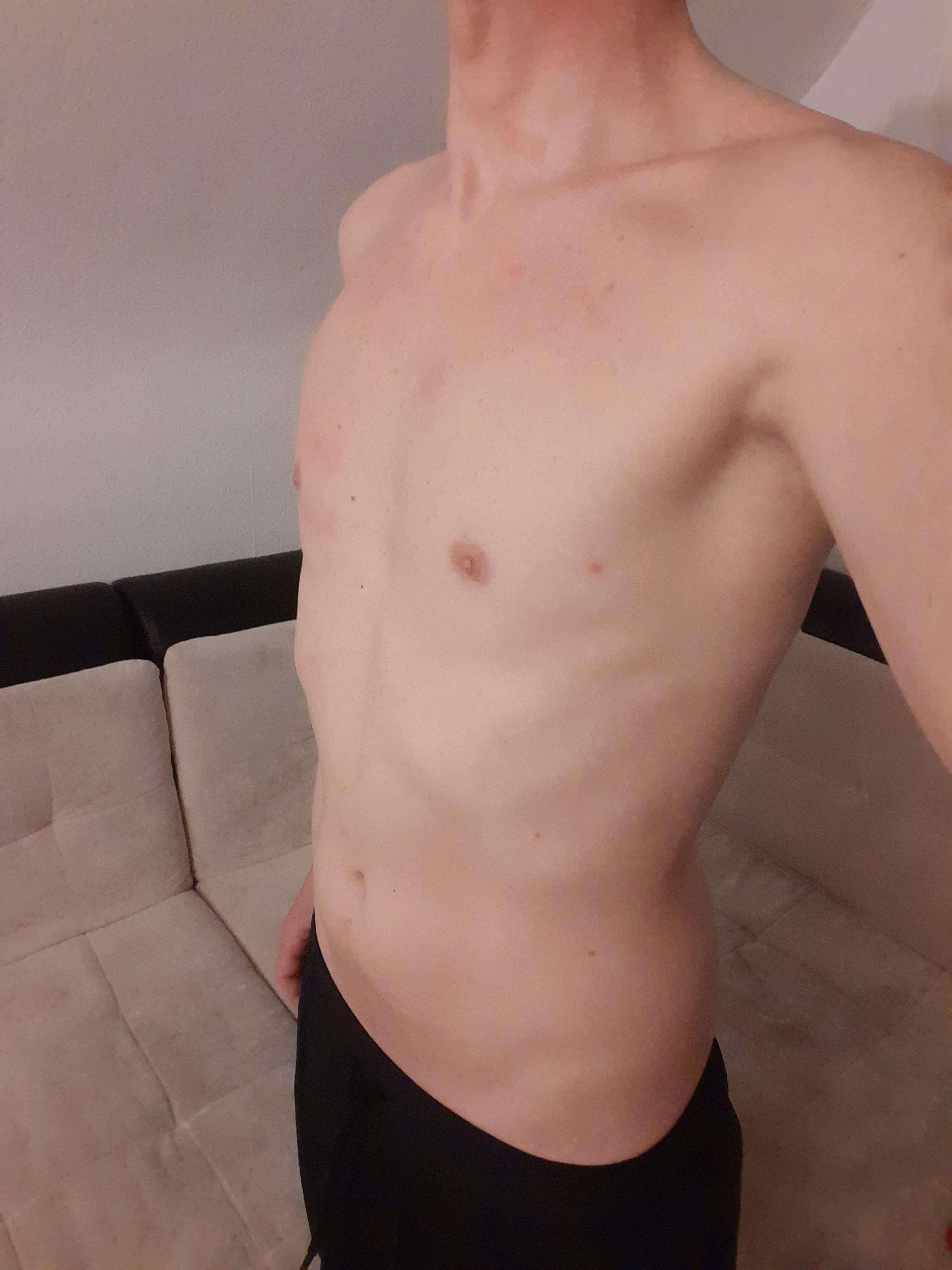Nymphofux from Germany